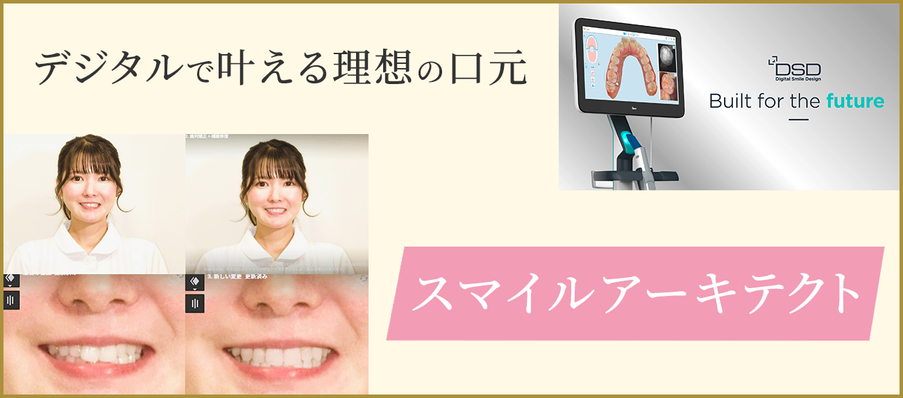 デジタルで叶える理想の口元　スマイルアーキテクト